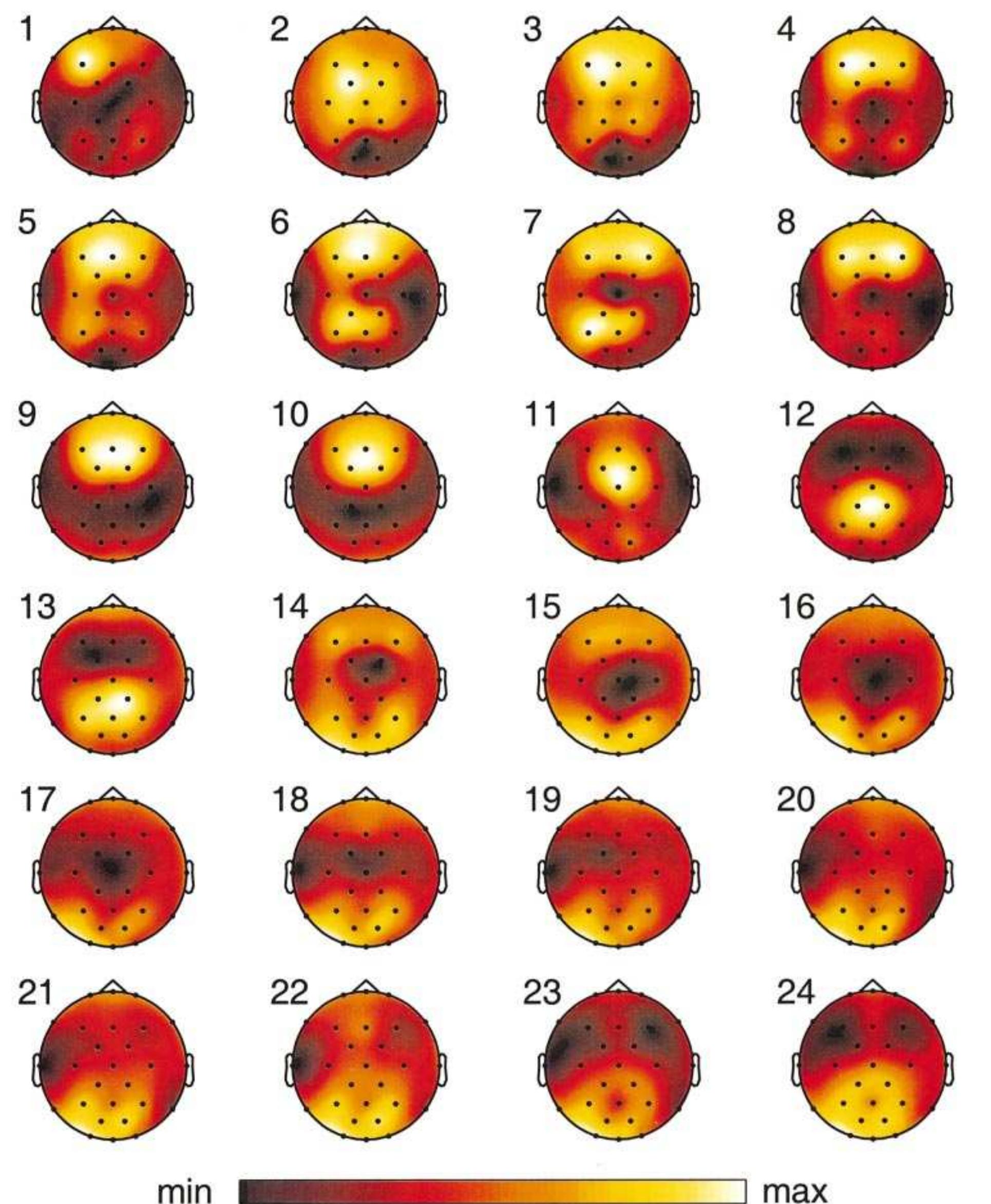Topography Map Sleep Plotly (PDF) Functional topography of the human nonREM sleep electroencephalogram