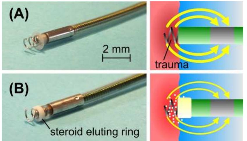 (PDF) Drug release mechanisms of steroid eluting rings in cardiac ...