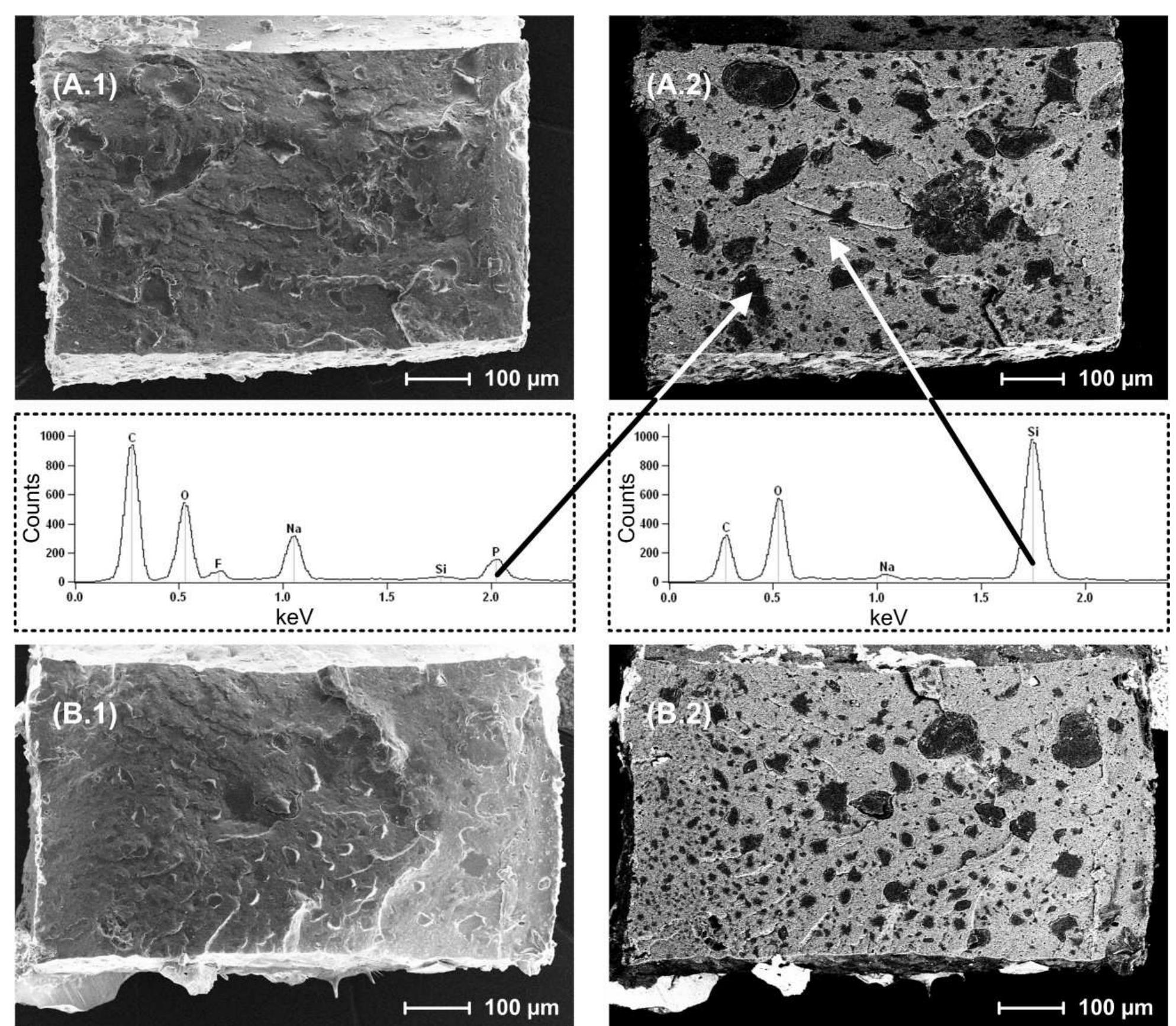 (PDF) Drug release mechanisms of steroid eluting rings in cardiac ...