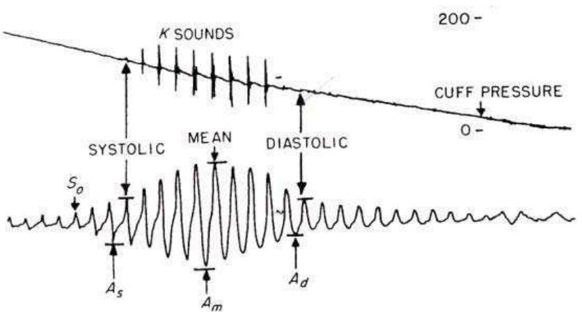 (PDF) Non-invasive blood pressure measurement: Auscultatory method ...