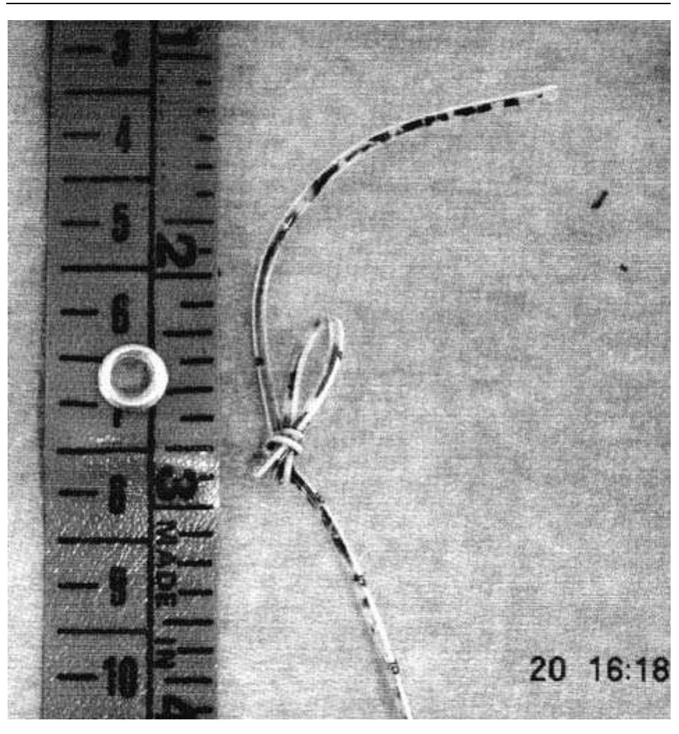 A tight double knot at 7 cm from the tip of a peripher- ally