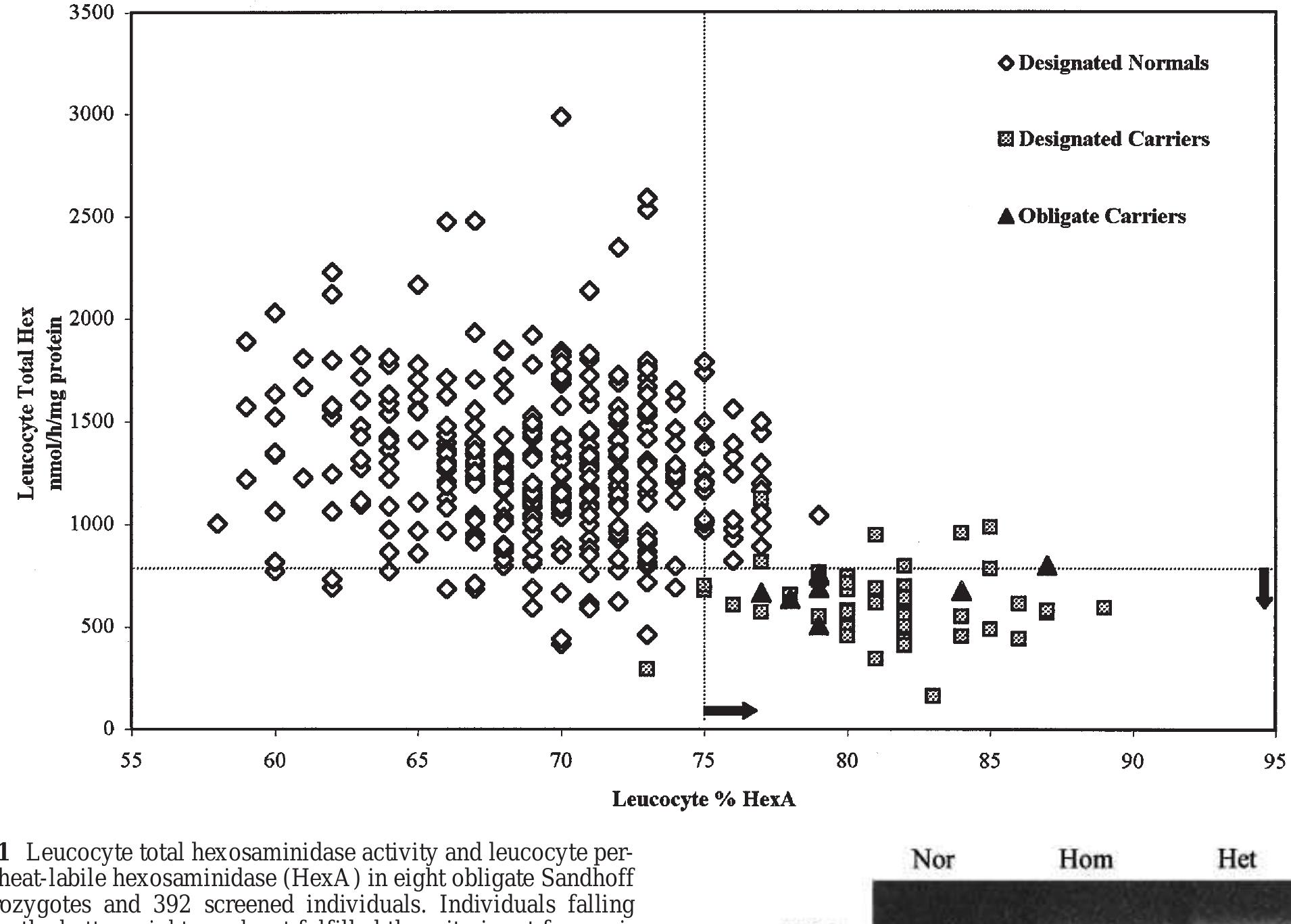 PDF) Sandhoff disease in Cyprus: population screening by
