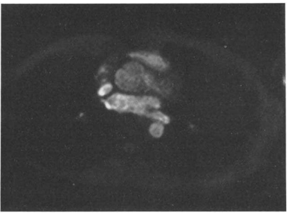 Scanner Interleave Cardiac image obtained by interleaved square-spiral scan