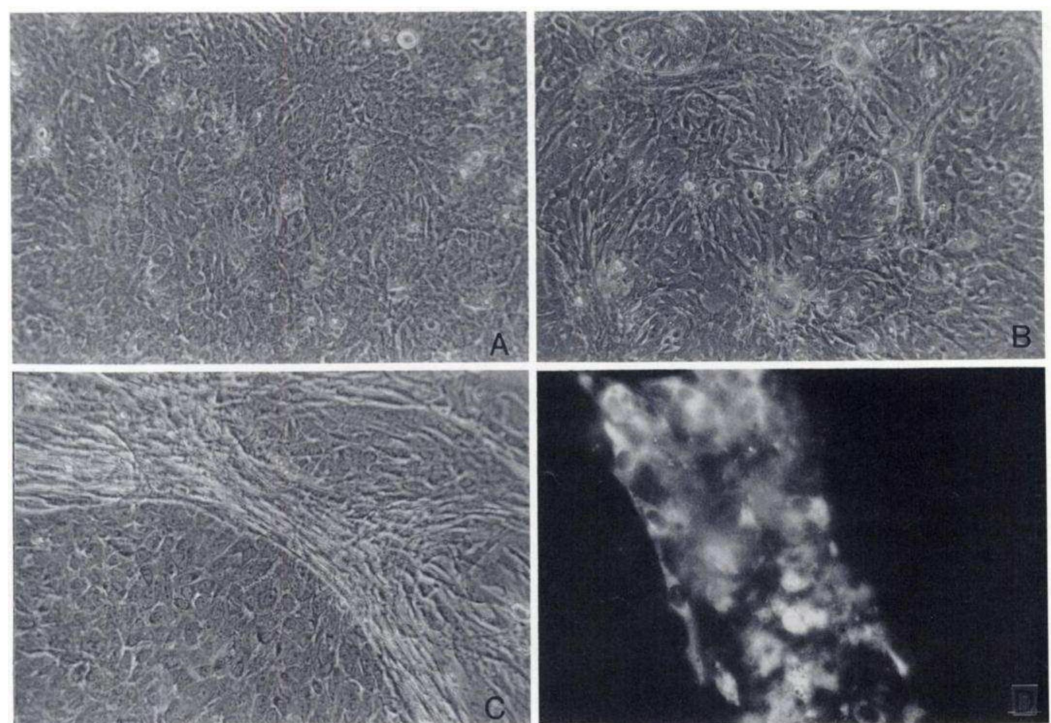 Light microscopy of mammary epithelial cell lines. a, fsk3