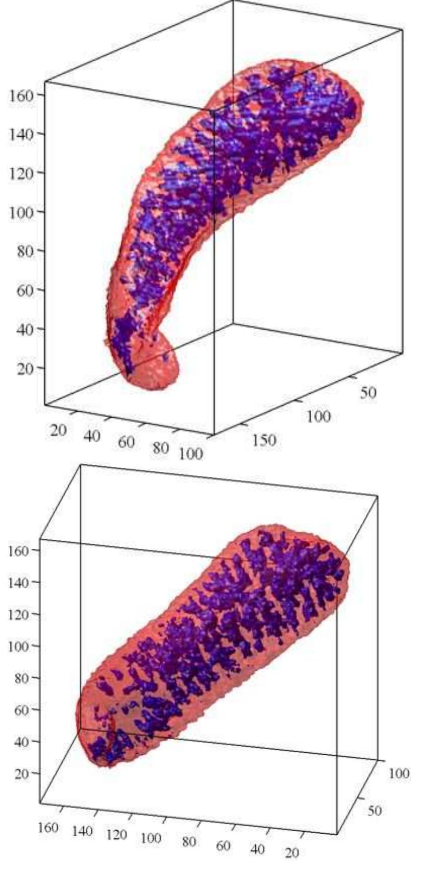 Spleen Inverted Follicles (inside transparent spleen) found using the