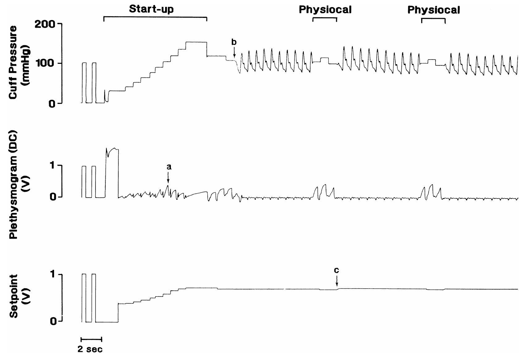 (PDF) Fifteen years experience with finger arterial pressure monitoring ...
