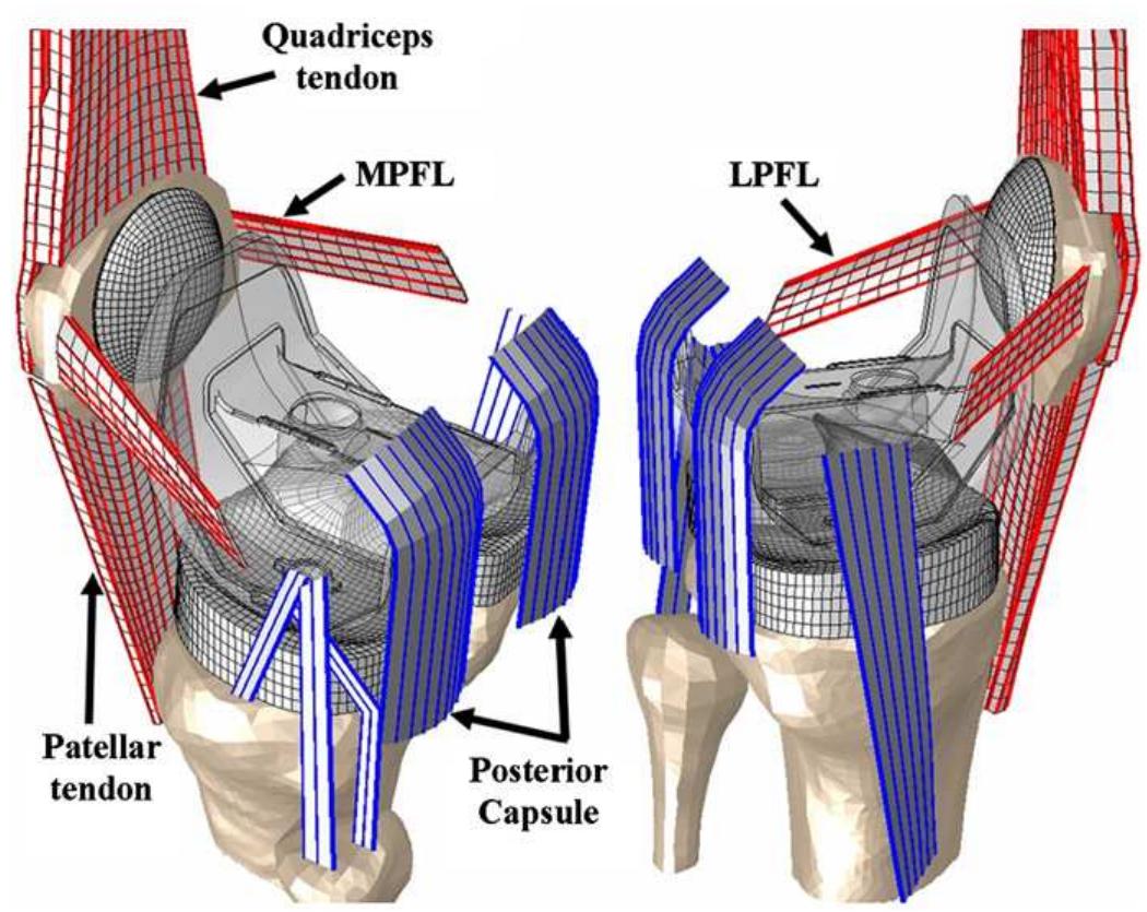 Specimen-specific implanted model with 3d extensor mechanism