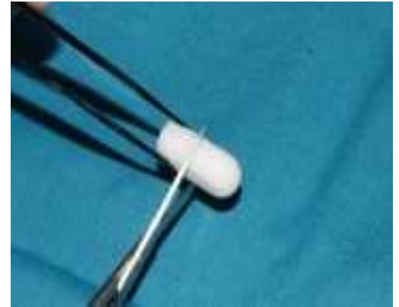 (PDF) Socket Preservation In Anterior Region