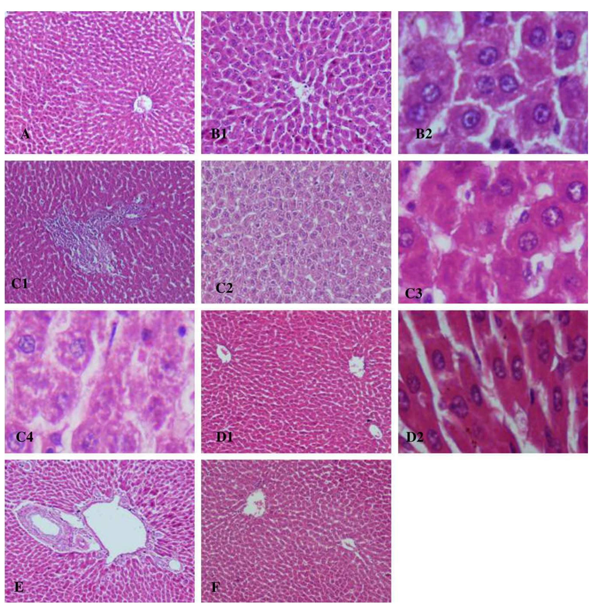 Photomicrographs of liver sections from: (a) a control rat