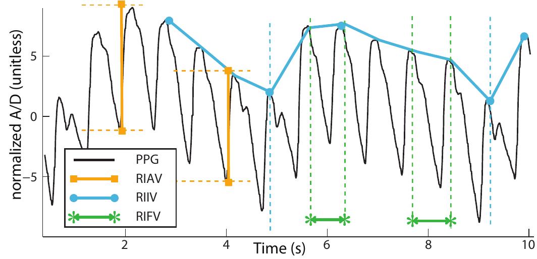 (PDF) Multiparameter Respiratory Rate Estimation From the ...
