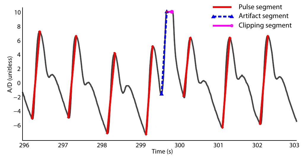 (PDF) Multiparameter Respiratory Rate Estimation From the ...