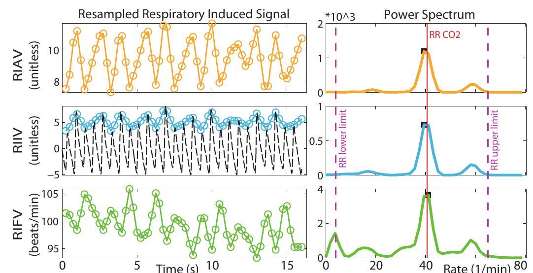 (PDF) Multiparameter Respiratory Rate Estimation From the ...
