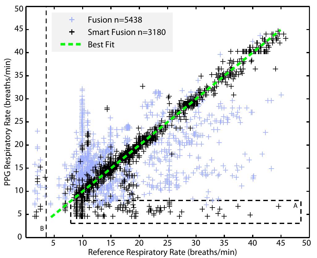 (PDF) Multiparameter Respiratory Rate Estimation From the ...