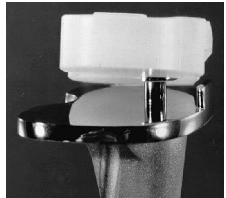 Tibia Snap Figure 2 - from Comparison of Mobile-Bearing and