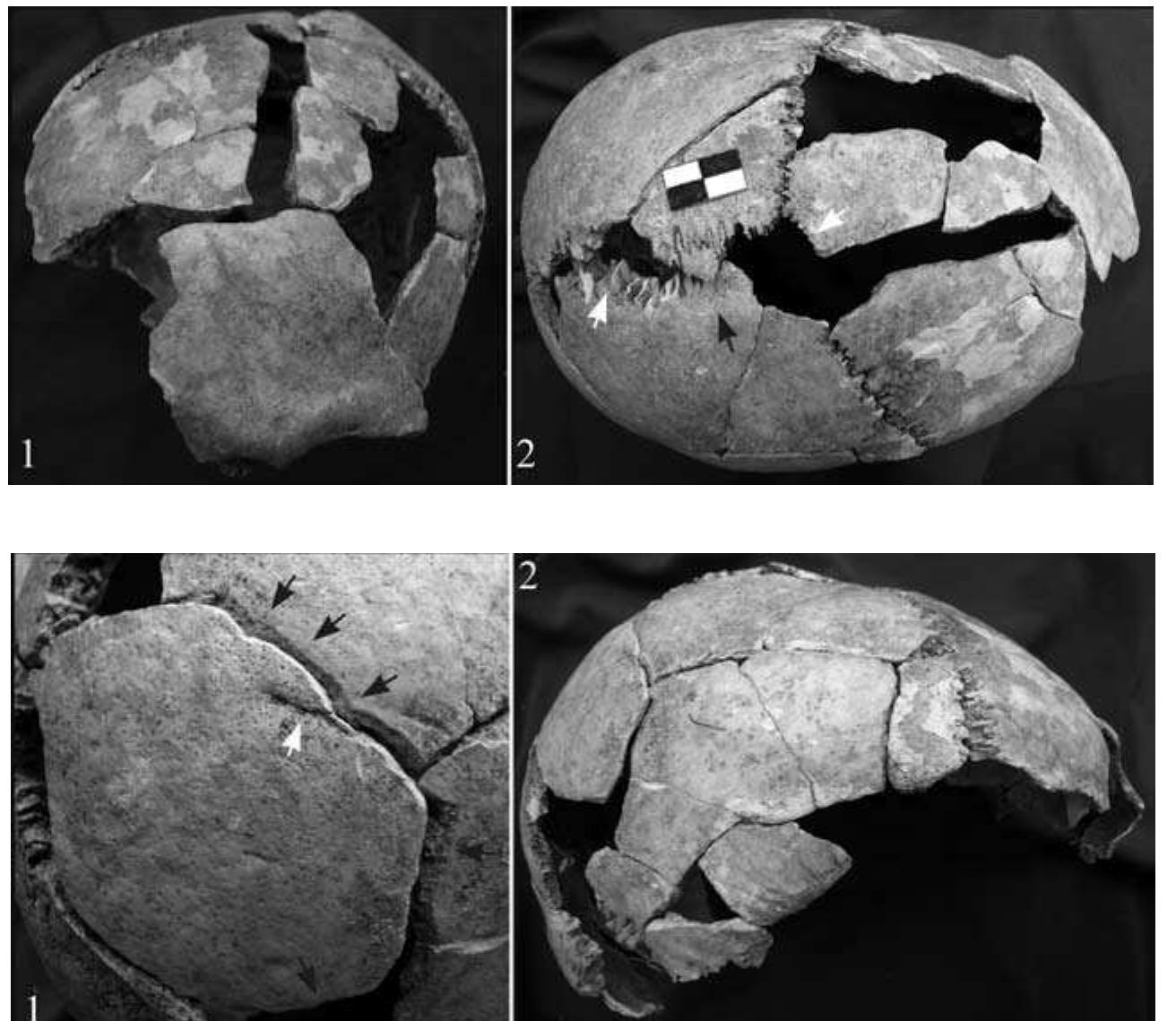 Figure 14 - from Human Skull Artifacts–Roundels and a Skull
