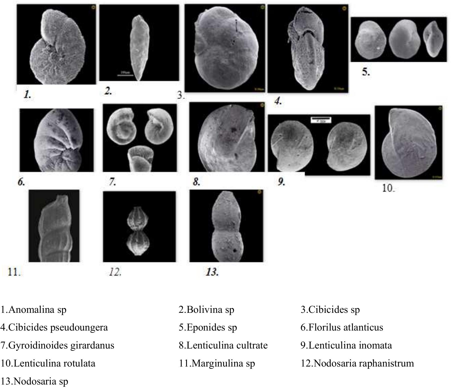Plate 2: diagnostic benthics foraminifera species recovered