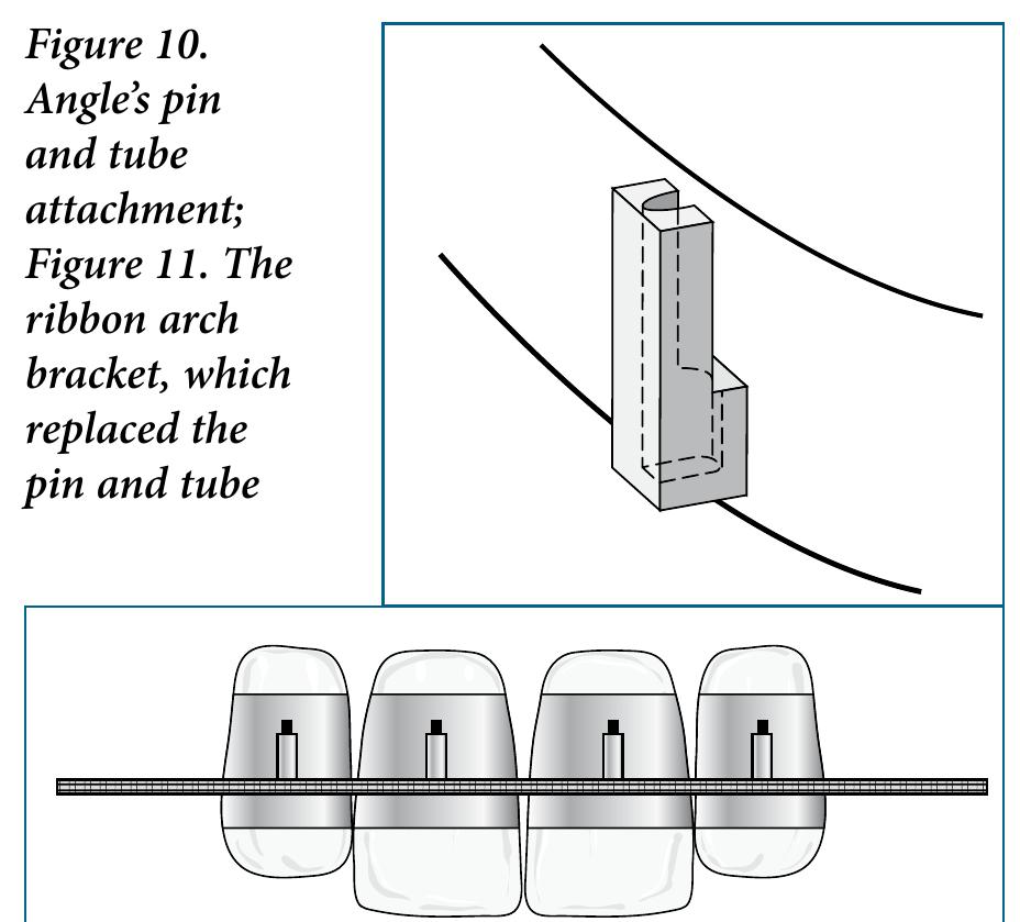 (PDF) The origins and evolution of fixed orthodontic appliances