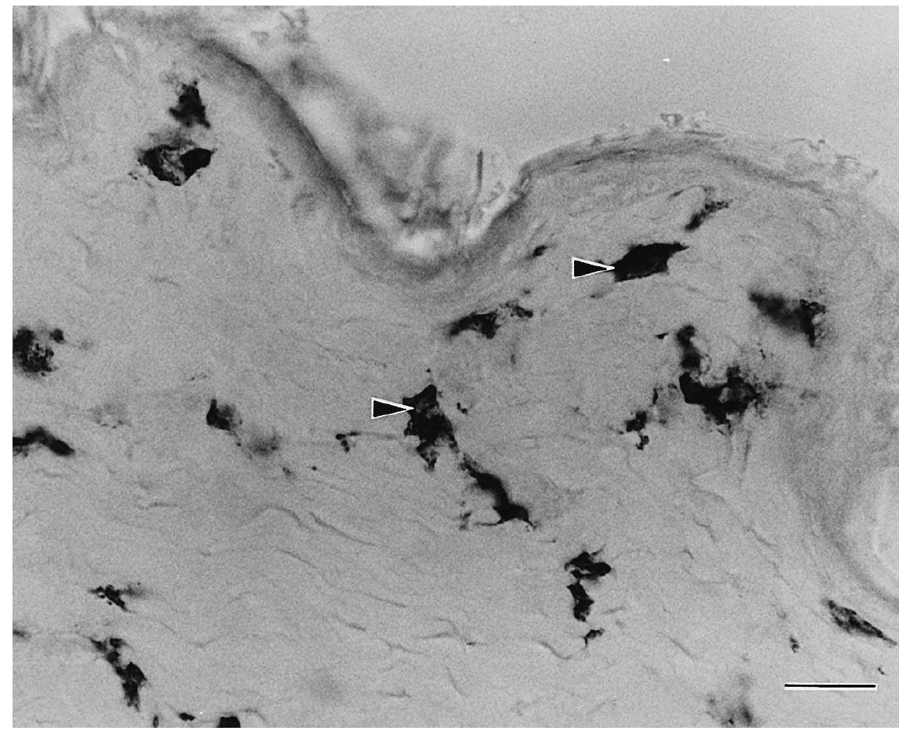 Immunohistochemical staining of the caecal tonsil of a