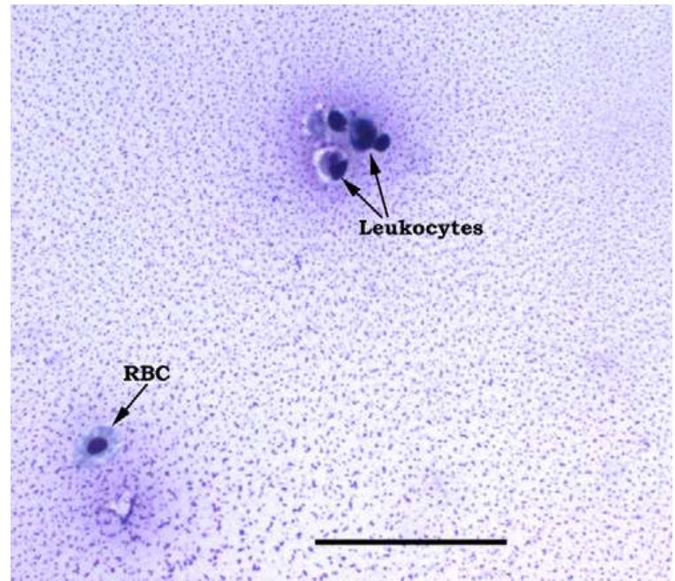 Fish Rbc Illustration Figure 6 - from Diagnostic Cytology of Fish