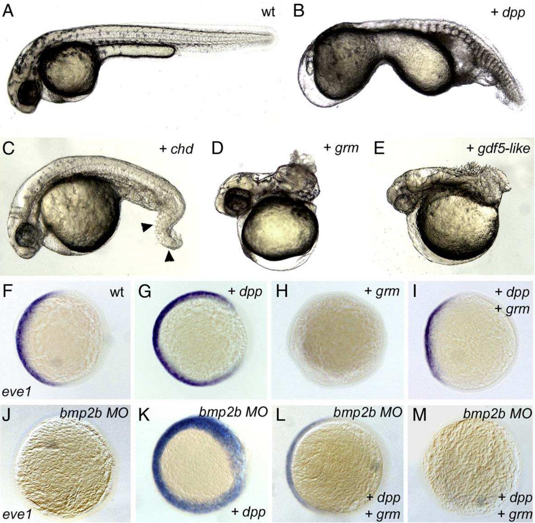 Mrna Injection Zebrafish Zebrafish microinjection experiments reveal functional
