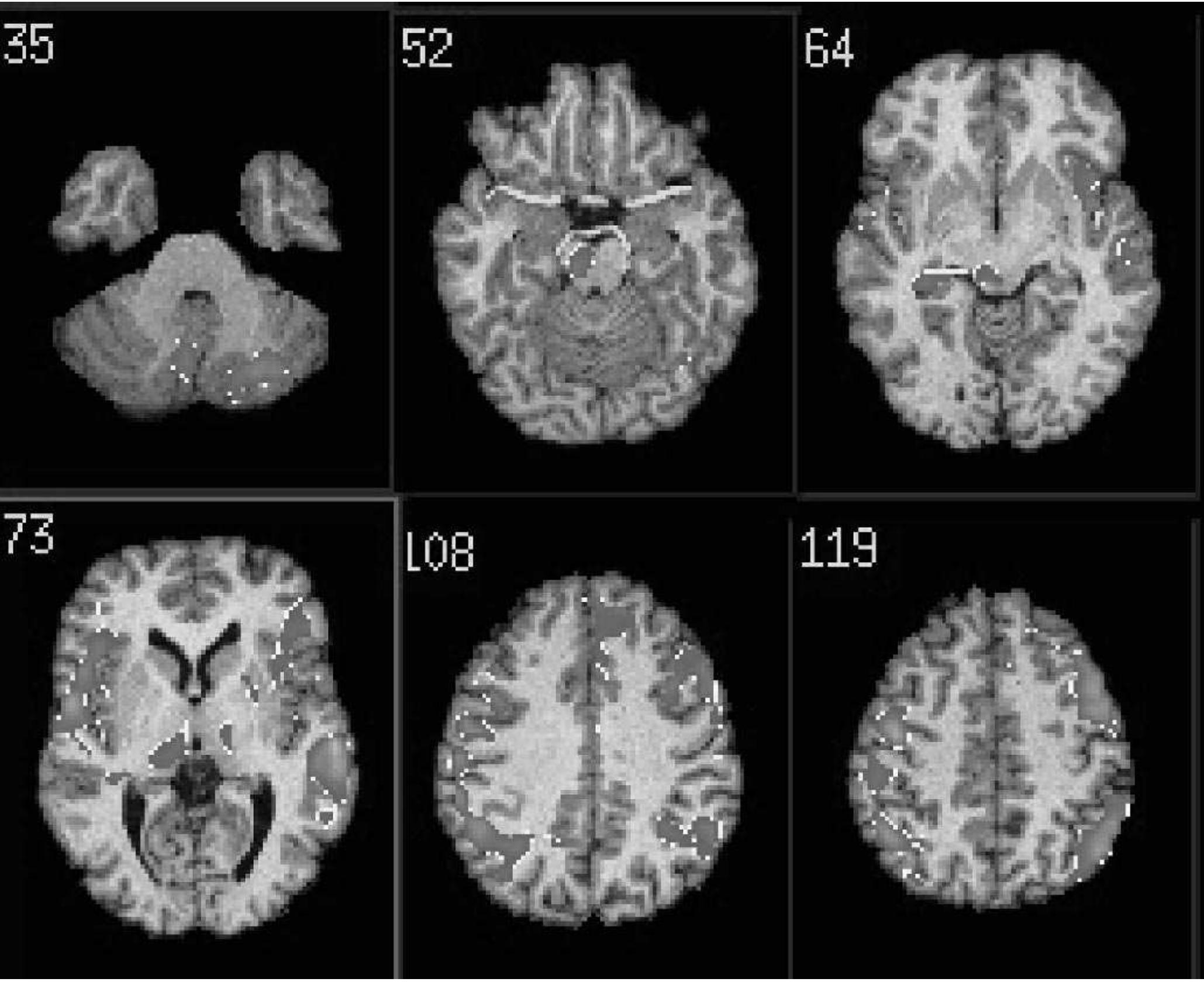 Figure 1 - from Mechanisms and State of the Art of