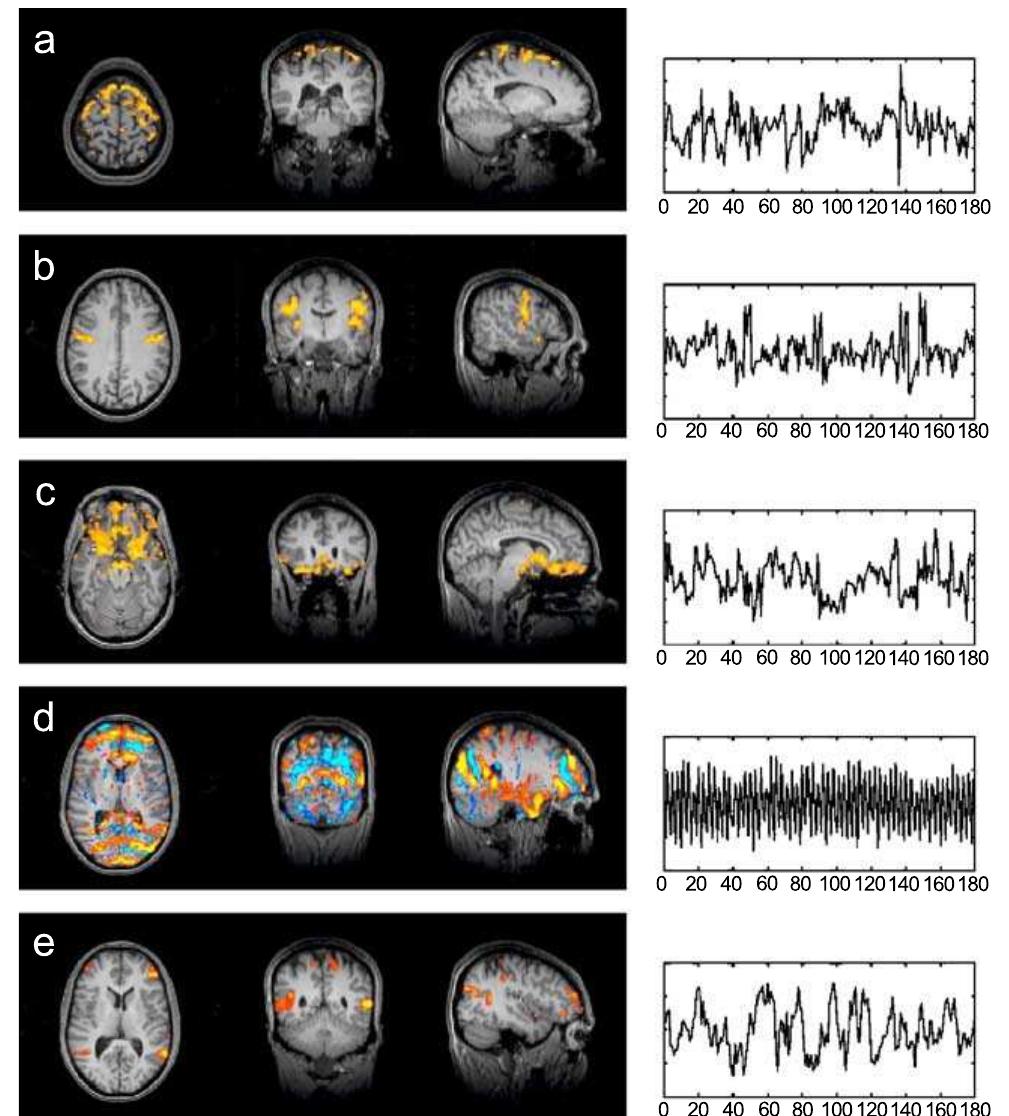 Figure 1 - from MRITool 2.0: a Matlab tool for functional
