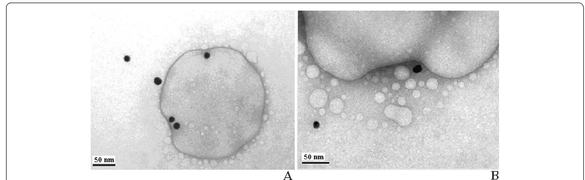 Figure 2 - from Gold nanoparticles - the theranostic