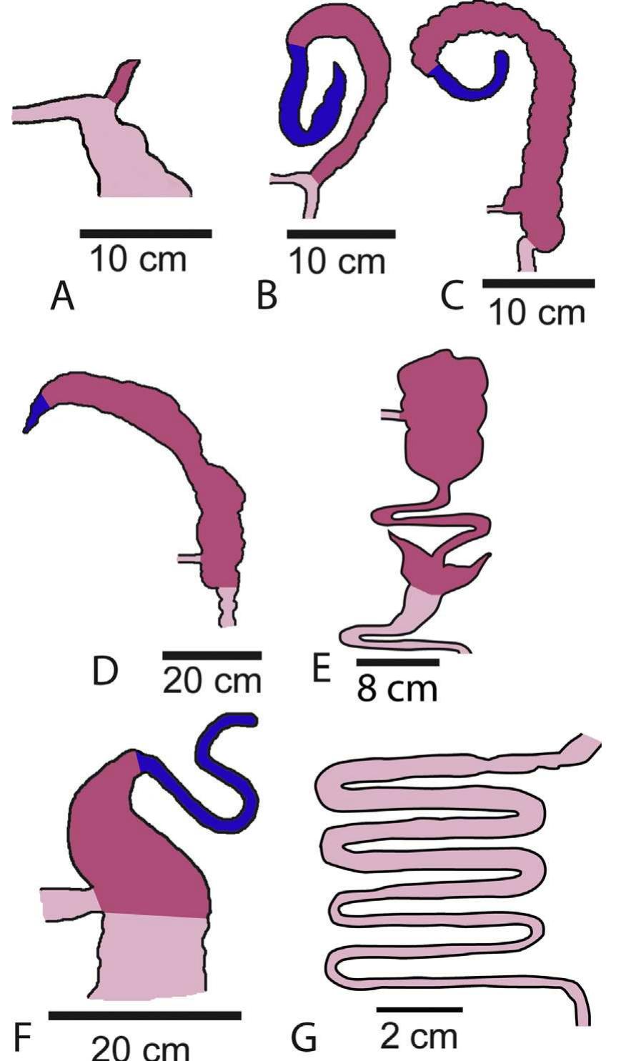 Fig. 1. Illustration of the seven cecal character states included in this study (see also Table 1, character 8): (A) appendix-like cecum of a com- mon wombat (Vombatus ursinus); (B) spiral-shaped cecum of a common brushtail possum (Trichosurus vulpecula); (C) elongated, tapering cecum of a rabbit (Oryctolagus cuniculus); (D) cylindrical cecum of a North Amer- ican beaver (Castor canadensis); (E) paired ceca (or colonic appendages) in a rock hyrax (Procavia habessinica); (F) rounded cecum of an orangutan (Pongo pygmaeus); (G) absent cecum in a bush-tailed phascogale (Phasco- gale tapoatafa). The cecum (dark pink or dark grey) and appendix (dark blue or darkest grey) are oriented toward the top of each drawing, the distal end of the small intestine toward the left, and the proximal end of the large intestine toward the bottom (both light pink or light grey). A cecal appendix is most frequently found in association with spiral (B) and tapering (C) cecal shapes. Images redrawn from Stevens and Hume (1995) and Hume (1999). Figure by Brent Adrian. 
