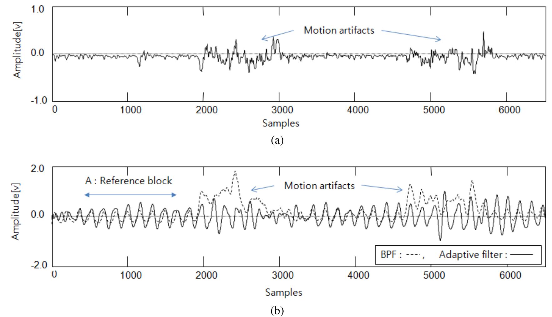 (PDF) Design of Filter to Reject Motion Artifacts of PPG Signal by ...