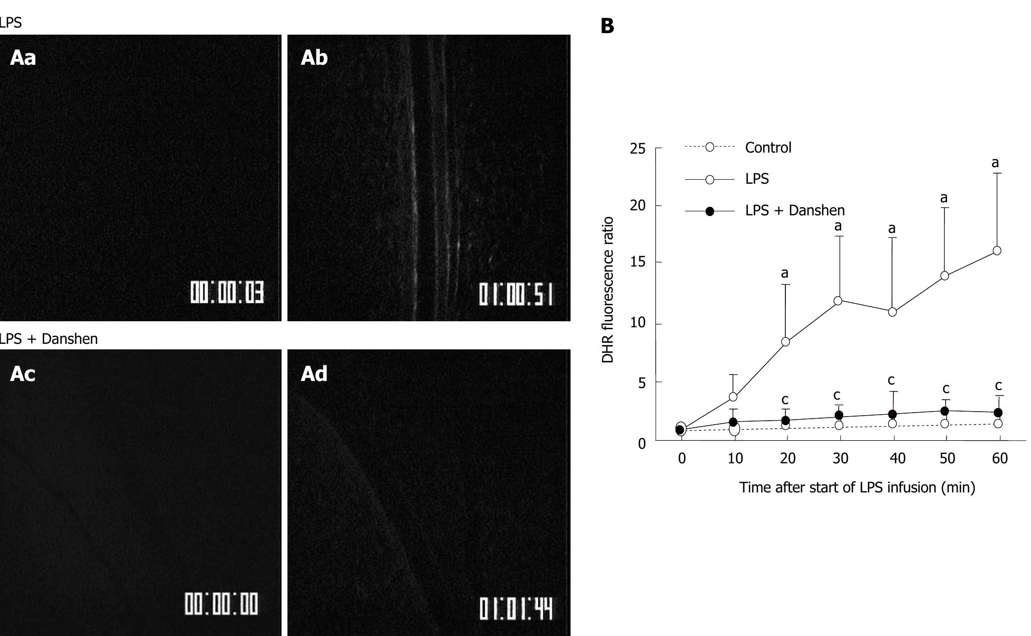 PDF) Lipoma induced jejunojejunal intussusception