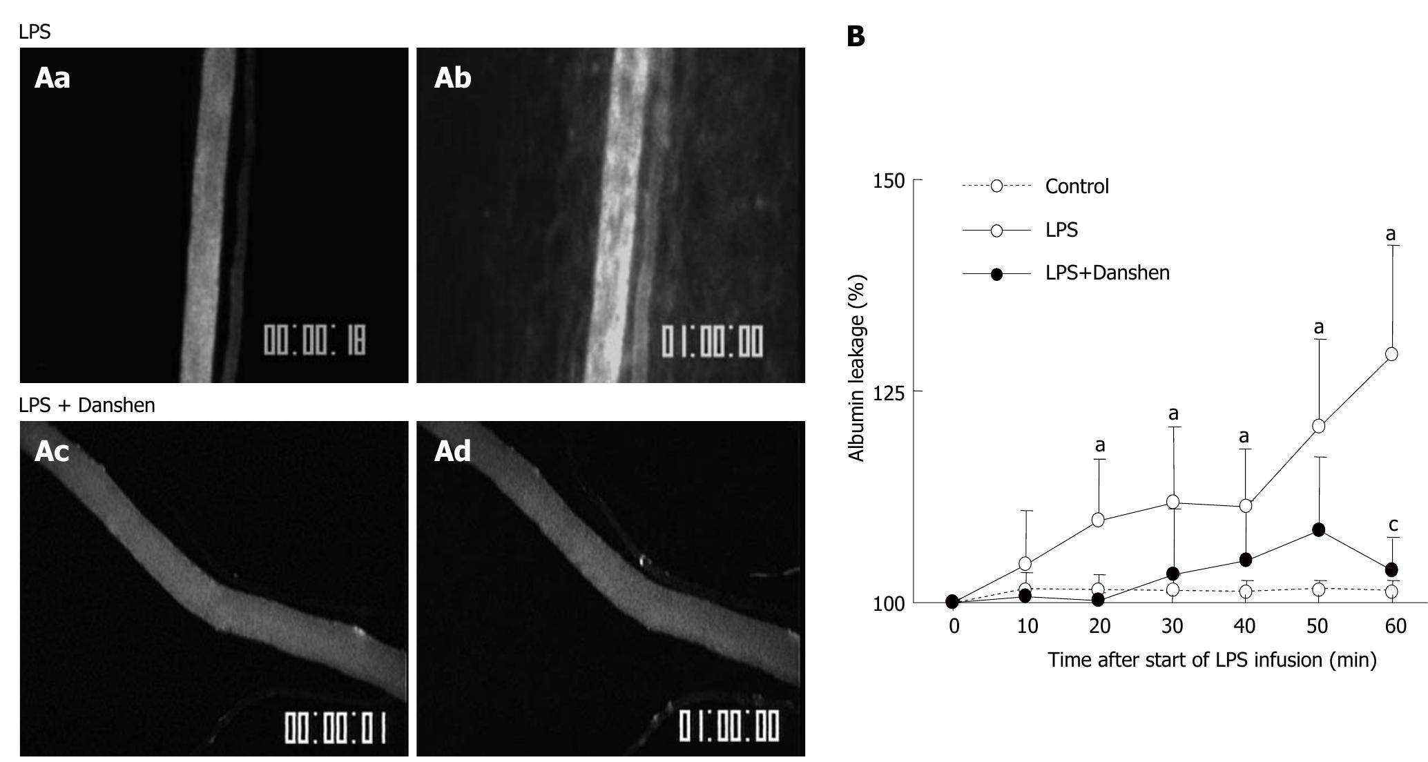 PDF) Lipoma induced jejunojejunal intussusception