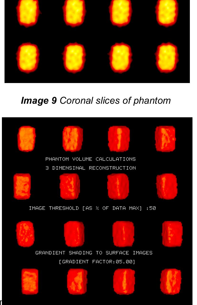 Spect Body Phantom Comparison of lpi of repeat scans in follow up studies