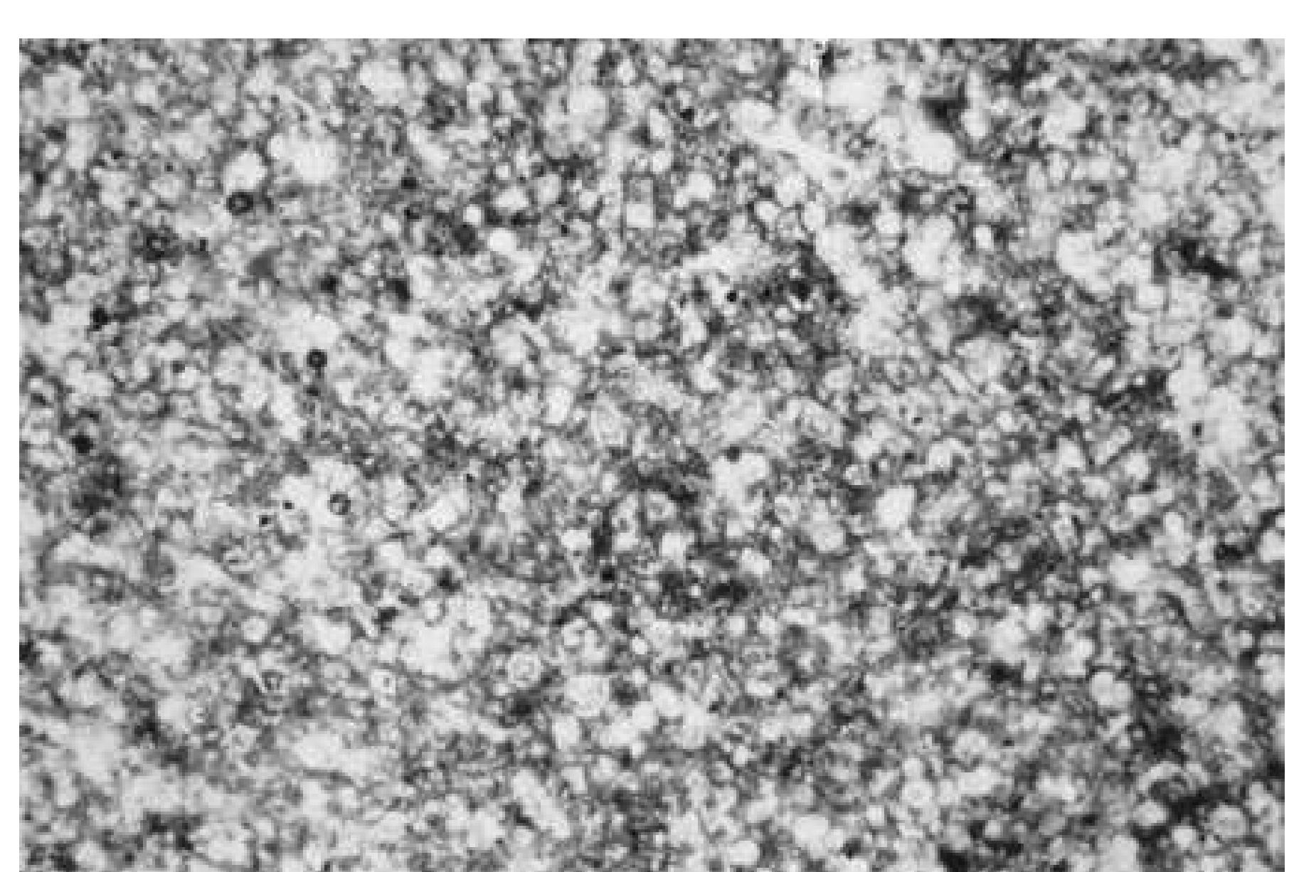 Photomicrograph of mudstones with planktonic microfauna