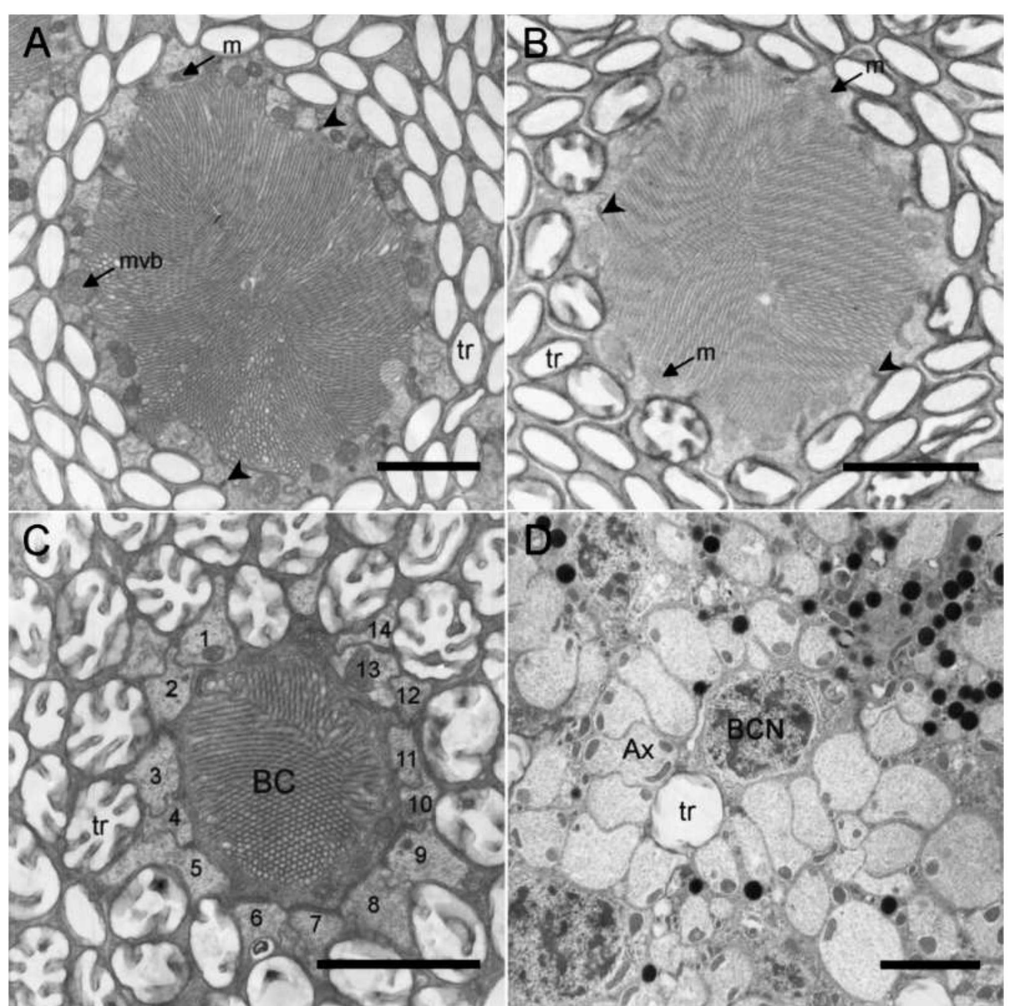 Electron micrographs of transverse sections through the