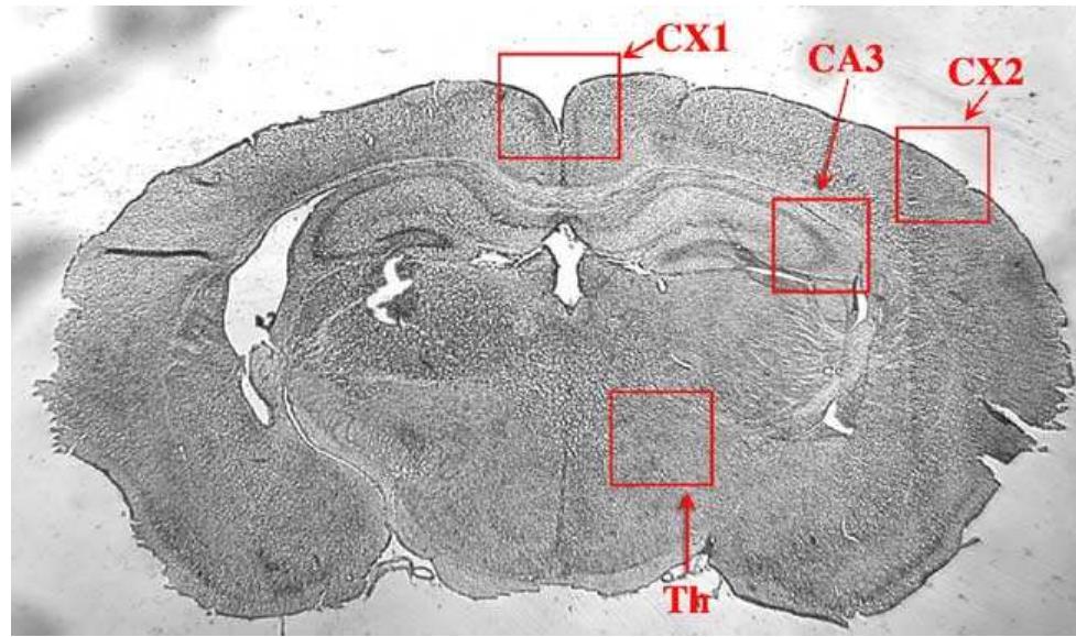 Nissl staining of a coronal brain section identifying