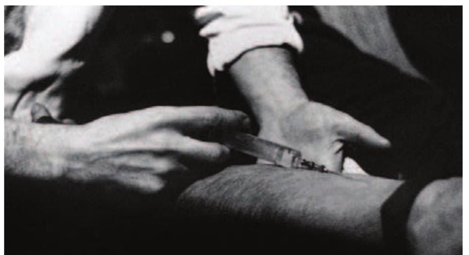 Figure 2. The protagonist is injected with Pentothal in La jetée (Argos Films, 1962). 