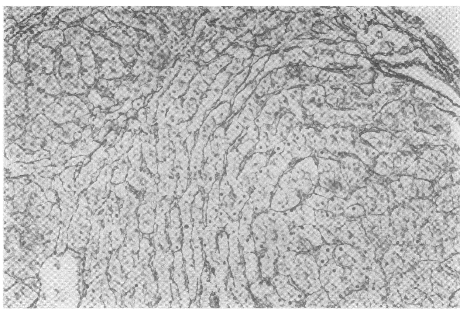 Figure 4 - The morphology of cirrhosis. Recommendations on