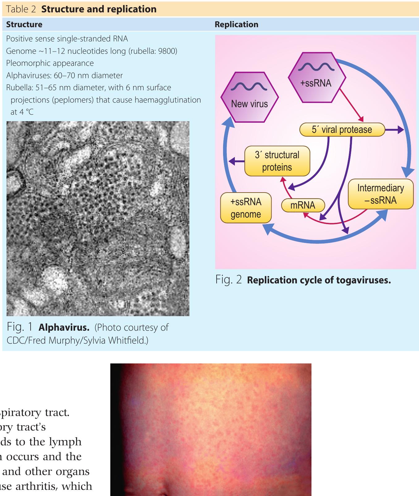 Rash caused by rubella. (photo courtesy of cdc)
