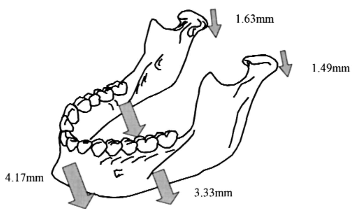 Figure 3 - Mandibular rest position: A reliable position