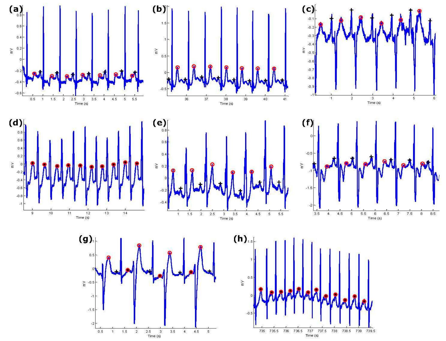 (PDF) A Proof-of-Concept Study: Simple and Effective Detection of P and ...