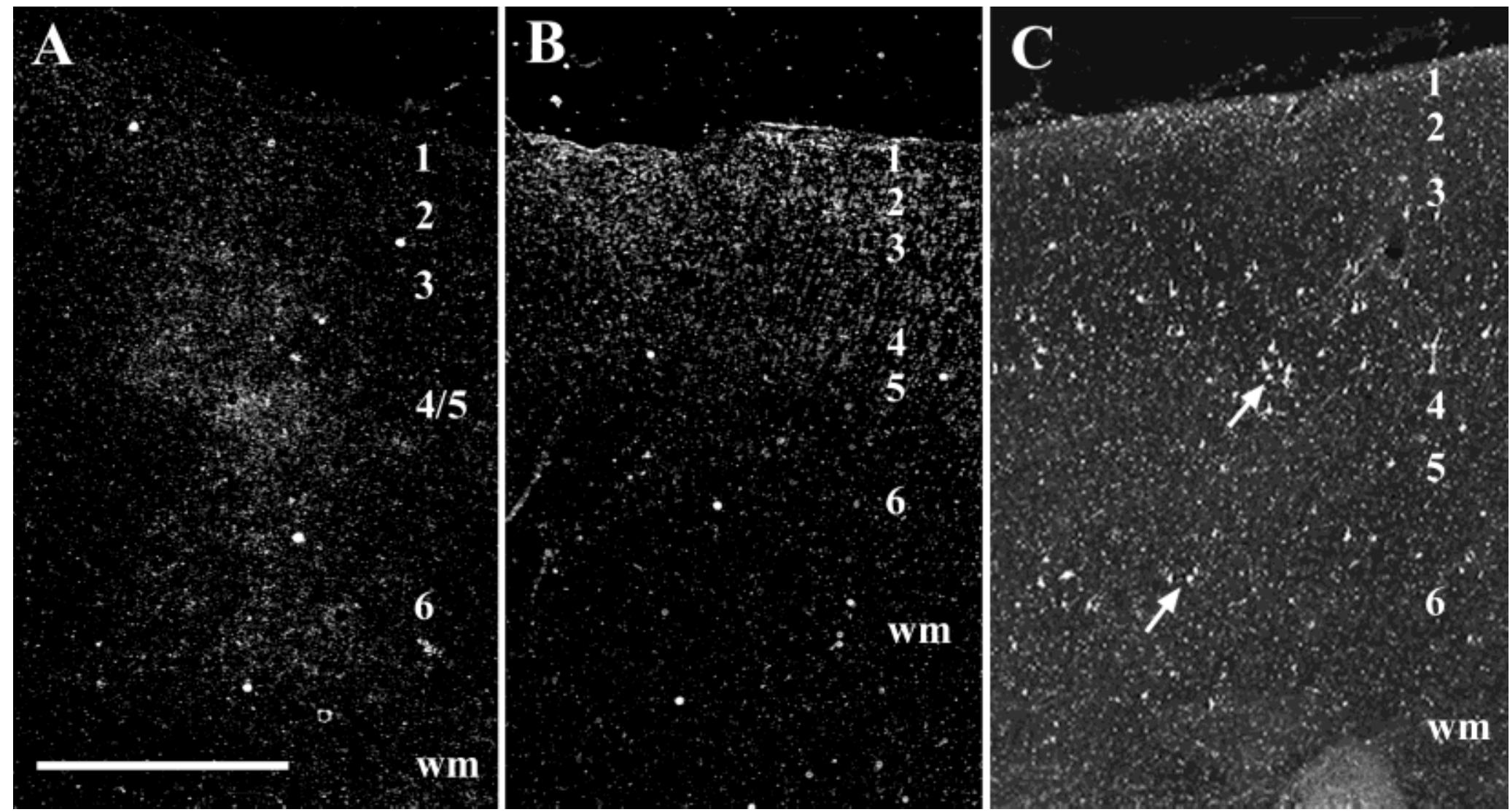 Hrp Neuron Figure 16 - from Medial Prefrontal Cortices Are Unified by