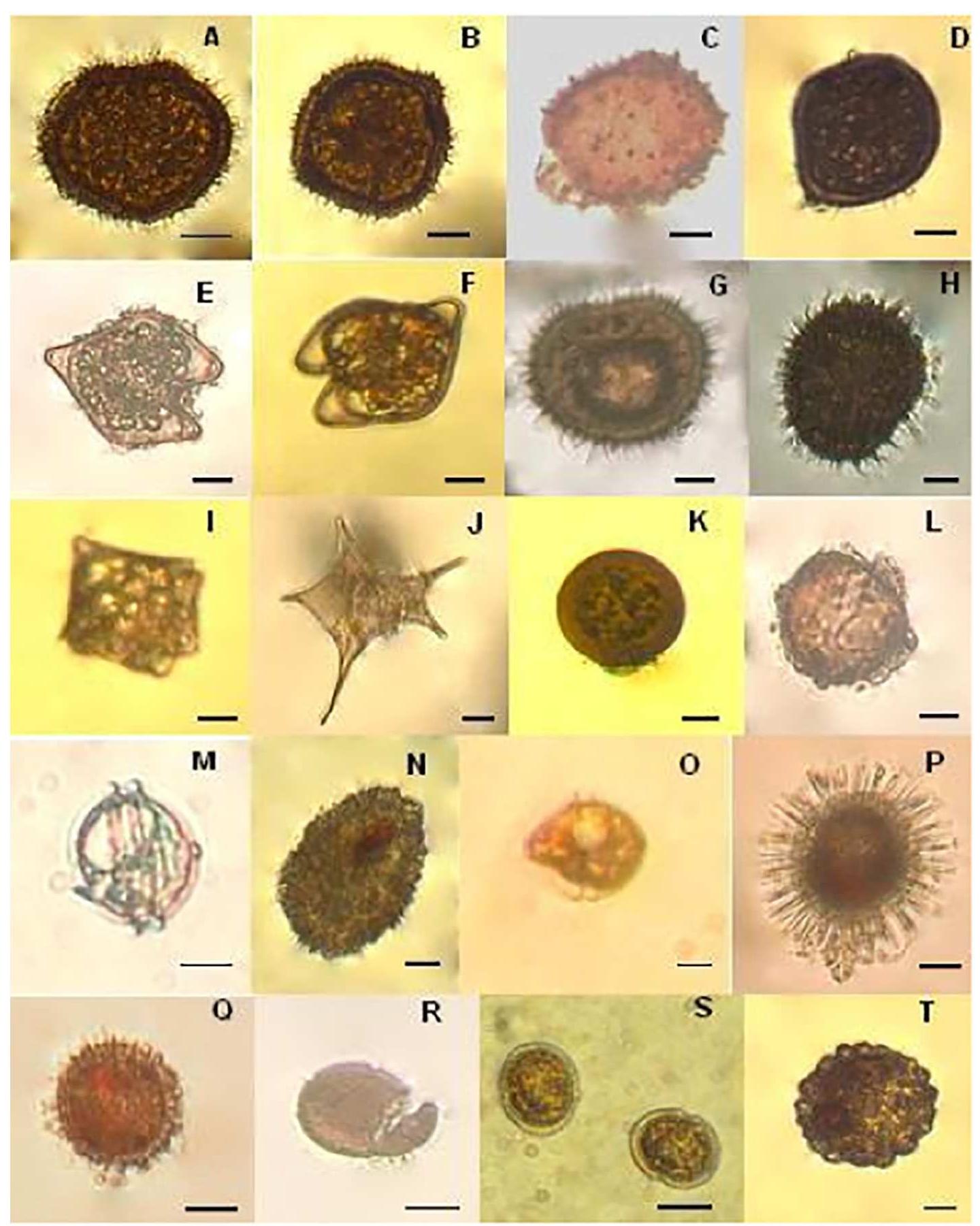 Fig. 6. A-T: Peridiniales cysts isolated from surface sediments within Bizerte lagoon. Organic Peridiniales: Figs. A, B. Protoperidinium claudicans living cyst, Fig. C. Protoperidinium claudicans empty cyst, Figs. D-F. Protoperidinium oblongum living cyst, Figs. G, H. Protoperidinium conicum RCs, Fig. I. Protoperidinium conicum vegetative cell, Fig. J. Protoperidinium compressum, Figs. K, L. Diplopsalis lenticula living cyst and empty cyst, Fig. M. Diplopsalis lenticula vegetative cell, Calcareous Peridiniales: Figs. N, O. Scrippsiella trochoidea living cyst and vegetative cells, Fig. P. Scrippsiella cf. ramonii, Fig. Q. Scrippsiella cf. precaria, Fig. R. Scrippsiella rotunda, Fig. S. vegetative cells of Scrippsiella rotunda, Fig. T. Ensiculifera sp. Scale bar (10 um).  The spatial distribution of dinocysts in the benthic sediment of Bi- zerte lagoon is shown in Fig. 4. The highest cyst abundance was that of 2742 cysts-g~! DS, recorded at station 49 and the lowest one was 203 cysts-g~' DS recorded at station 25. Shannon-Wiener's diversity index values (H’) ranged between 0.21 and 0.73 bits-ind~ ' (Fig. 5). H’ values <0.5 bits-ind~' are normally associated with the dominance of biotic assemblages by a relatively small number of taxa. The low H’ index values recorded in our study can be attributed to high densities  In the laboratory, germination occurred mostly during the first three days of incubation. Successful excystment of most brown (the prevail- ing cyst colour) cysts frequently gave rise to motile cells belonging to the genus Protoperidinium, whereas excystment of rounded, colorless and walled cysts gave rise to motile stages of Alexandrium vegetative cells. Dinocyst assemblage was mainly represented by two groups: Peridiniales (33%) and Gonyaulacales (67%). A total of 22 cysts morphotypes representing 11 genera belonging to the following 4 or- ders were recorded within the entire Bizerte Lagoon sediment sampling area (Table 3): Peridiniales (Fig. 6), Gonyaulacales (Fig. 7), Gymnodiniales and Prorocentrales (Fig. 8). Two species dominated the dinoflagellate assemblage: A. pseudogonyaulax (29-89% of total RCs) and P. claudicans (5-38% of total RCs). A. pseudogonyaulax, the most abundant species, was present all over the lagoon and contributed sig- nificantly to the total cyst abundance. 
