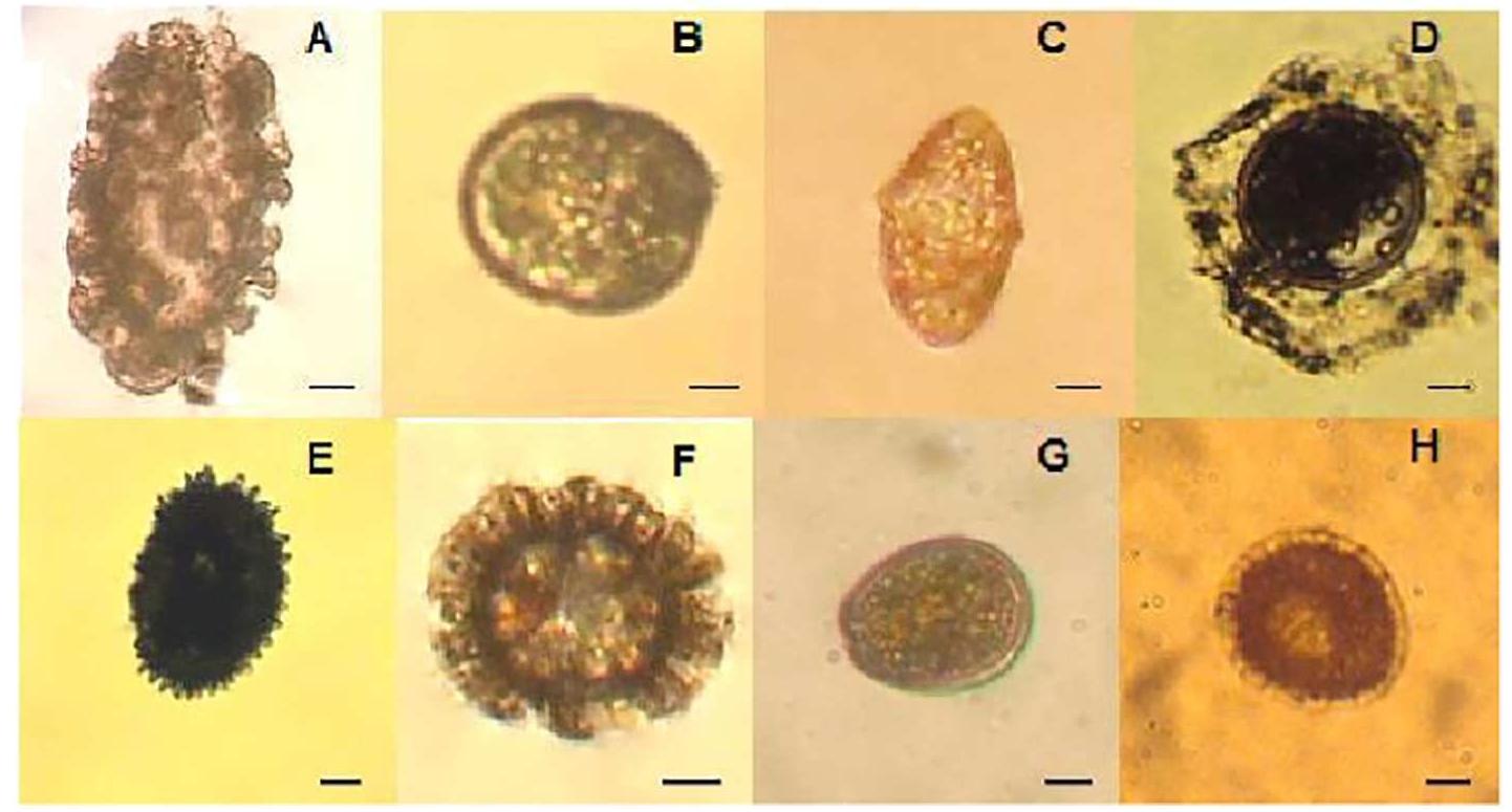 Fig. 8. A-H: Unidentified cysts, gymnodiniales and prorocentrales cysts isolated from the surface sediments within Bizerte lagoon. Fig. A. Polykrikos schwartzii/kofoidii complex, Figs. B, Gymnodinium spp. vegetative cells germinated from sediment, Fig. D. Gymnodinium sp., Figs. E, F, H. unidentified cysts, Fig. G. Prorocentrum cf. micans. Scale bar (10 um).  Total cyst density (cyst-g~! DS) = 13.43 Cr — 2.941 Hg — 2566 Cd + 82.25 Cu — 66.37 Ni + 23.67 H,0.  The Pearson correlation analysis revealed a positive correlation between cyst abundance and sediment water content (a@ = 0.01) and sediment fine silt content (a = 0.05). Results are presented in Table 1. PCA was performed to investigate any correlation between the RC densities (considered as a supplementary factor), the sediment characteristics (texture, organic matter, H,O percentage) and the contaminant concentrations (Fig. 9). Axes 1 and 2 accounted for 53.2% of this correlation. PC2 explained the highest part of the correlation (39.6%) and was mainly represented by trace metal concentrations. PC1 axis was mainly represented by sediment characteristics. Hierarchical clustering on stations based on RC abundance and contaminants revealed a correspondence between the 