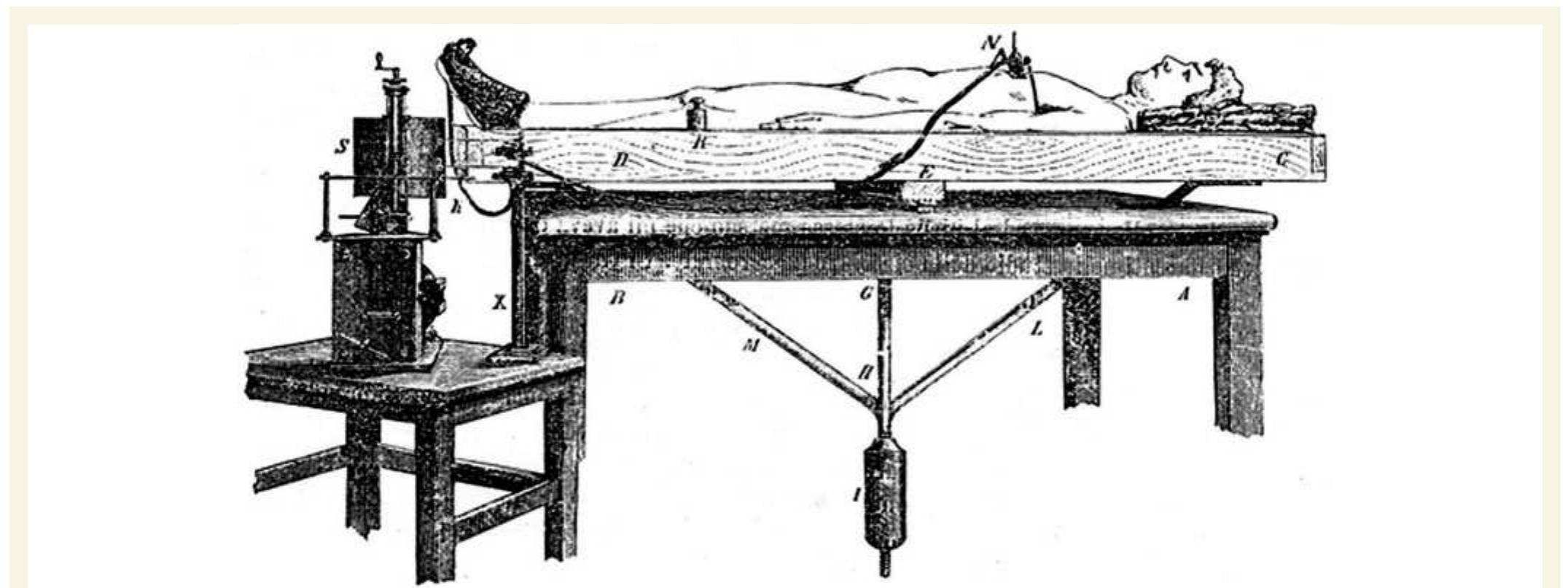 (PDF) Angelo Mosso (1846–1910)