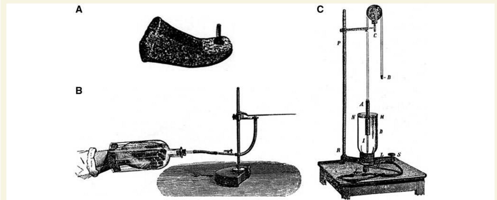 (PDF) Angelo Mosso (1846–1910)