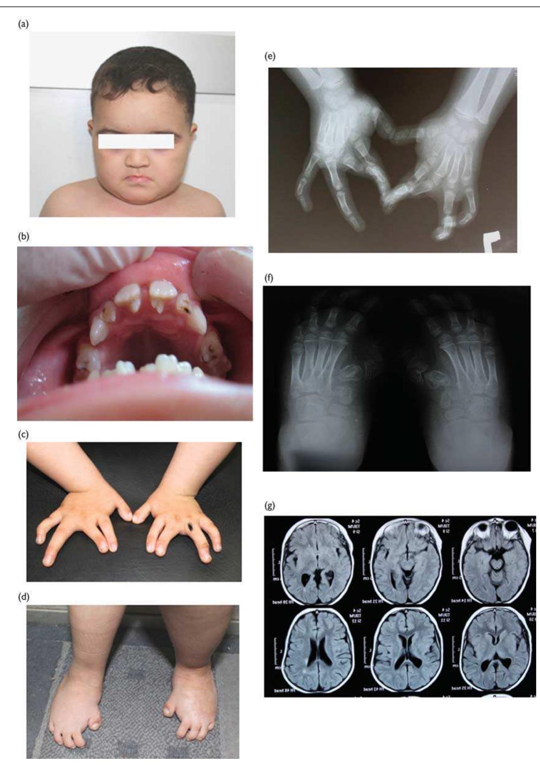 Figure 2 - from Definition of the phenotypic spectrum of