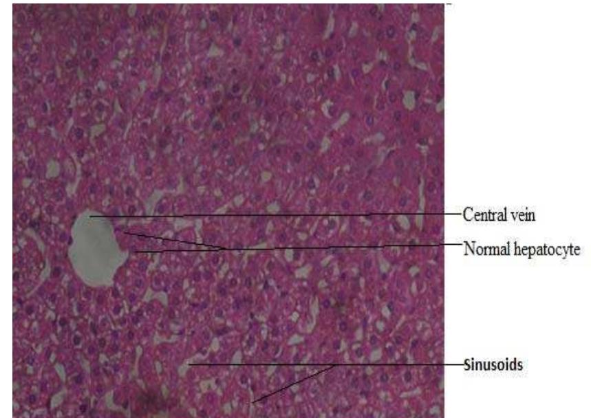 A photomicrograph of guinea pigs liver from the controlgroup