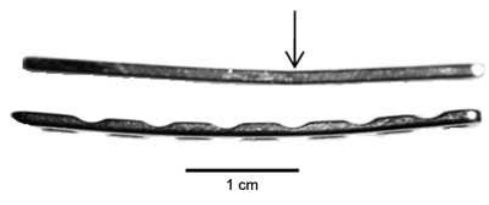 Figure 3 - from In Vitro Mechanical Comparison of 2.0 and