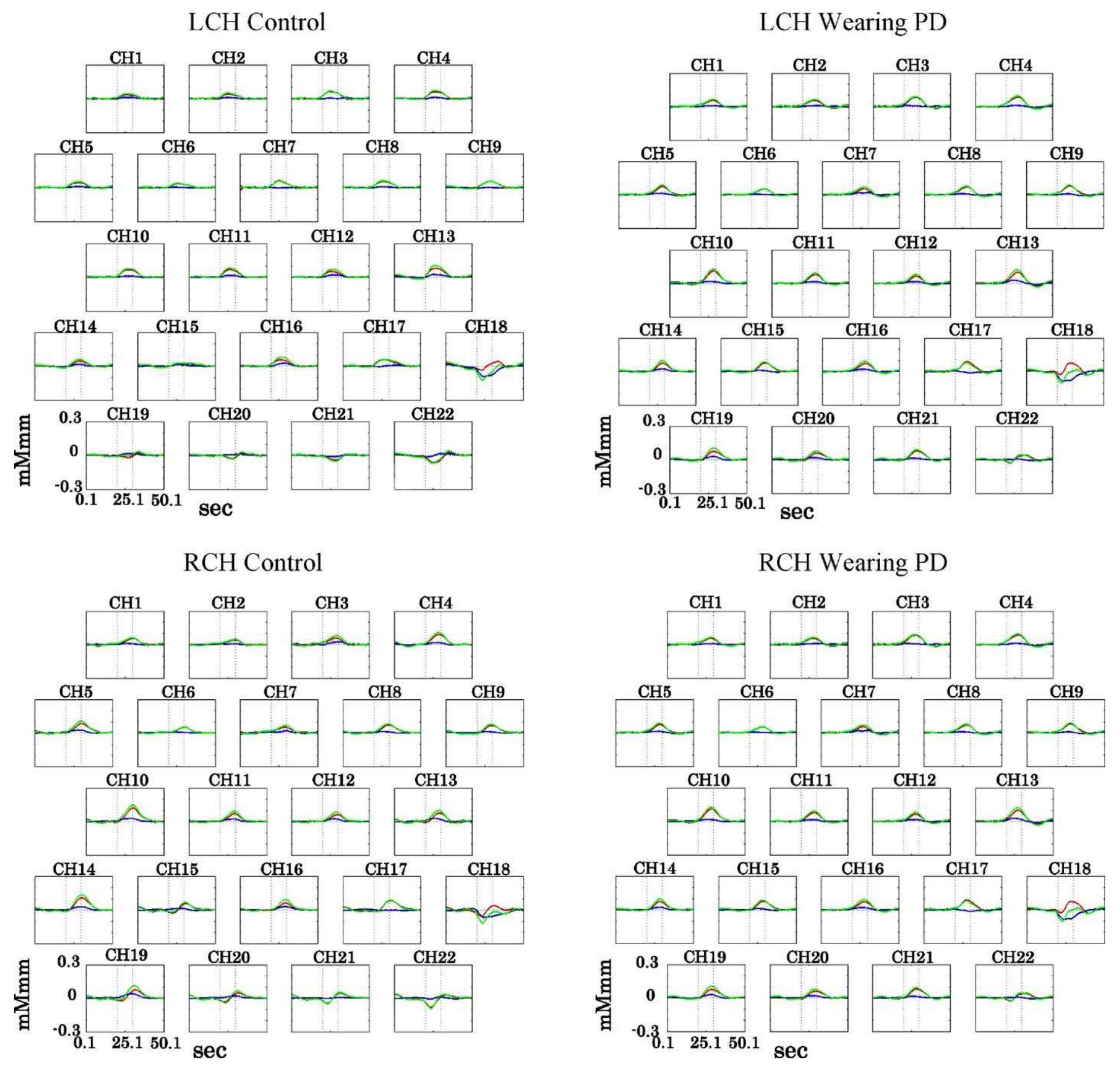 Hb Map Measurers (PDF) Chewing-related prefrontal cortex activation while wearing ...