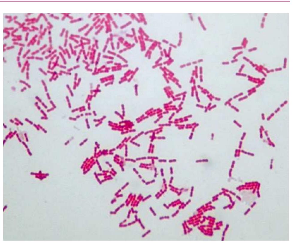 Figure 1 - from Kingella kingae: from medical rarity to an